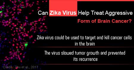 Zika Virus can Possibly Treat Brain Cancer