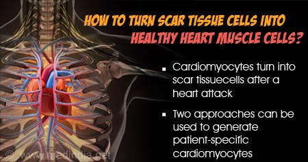 How Scar Tissue can be Turned Back into Functioning Heart Muscle