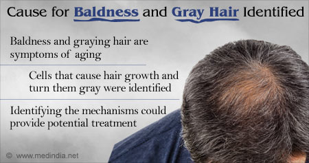 Causes of Baldness and Gray Hair