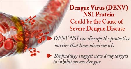 Cause of Vascular Leakage in Severe Dengue