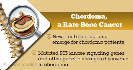 New Treatment for Chordoma