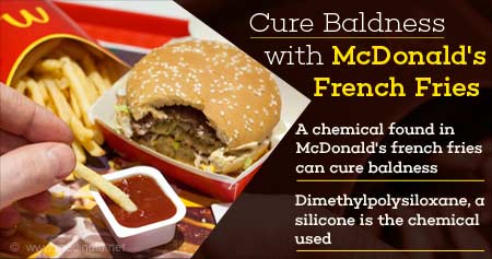 McDonald's French Fries can Cure Baldness
