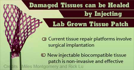 Injectable Tissue Patch to Repair Damaged Tissues