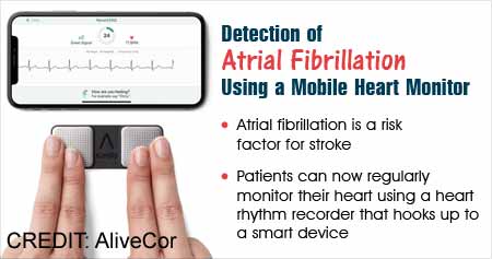 Smartphone Monitoring System Detects Atrial Fibrillation with Excellent Sensitivity
