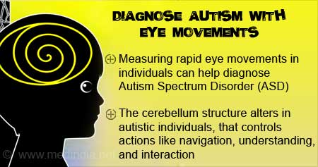 Health Tip to Diagnose Autism Spectrum Disorder with Eye Movements