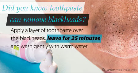 Health Tip To Get Rid of Blackheads