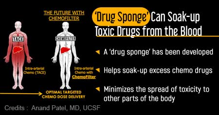 'Drug Sponge' Could Minimize Chemotherapy Side-effects