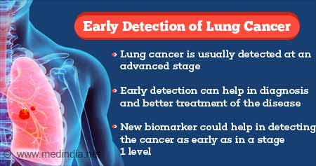 Early Detection of Lung Cancer Possible With New Biomarker