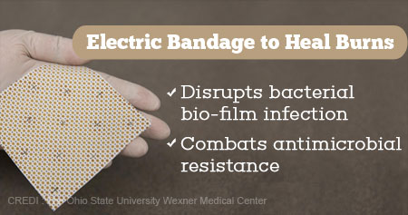 Electric Bandages to Heal Burns