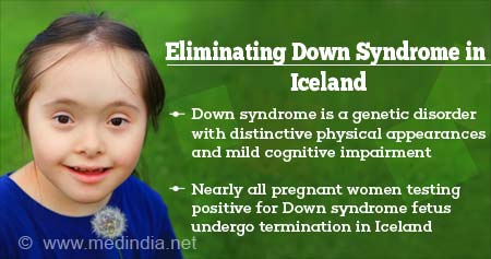 Eliminating Down Syndrome in Iceland