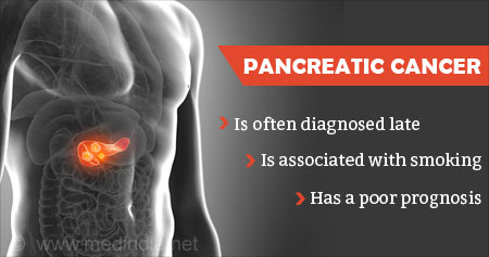New Treatment for Pancreatic Cancer
