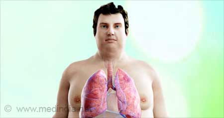 肥胖人群肺部脂肪沉积可能增加哮喘风险