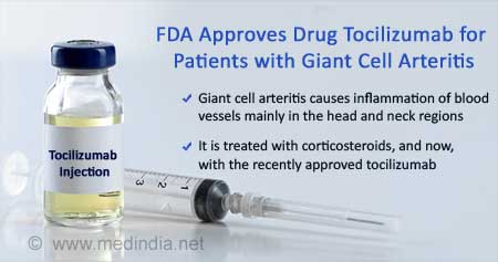 FDA Approved Drug for Giant Cell Arteritis