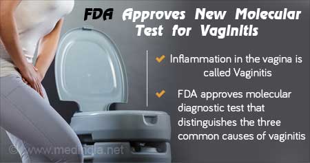 FDA Approved Molecular Test for Vaginitis