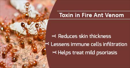 Toxin In Fire Ant To Reduce Psoriasis Inflammation