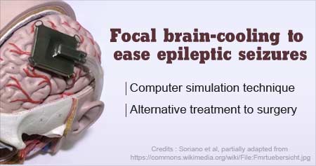 Brain Cooling to Treat Epilepsy