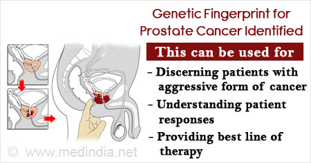 New Genetic Fingerprint to Help Identify Prostate Cancer