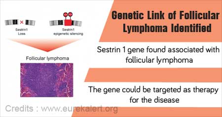 Link Between Follicular Lymphoma and Sestrin1 Gene Detected