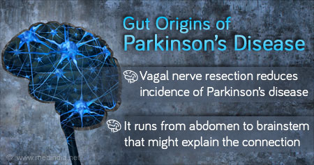 Gut Origin of Parkinson's Disease