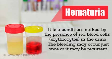 Hematuria (Blood in the Urine)