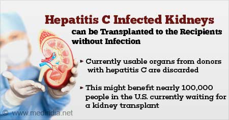 Hepatitis C-positive Kidneys can be Transplanted Without Infection