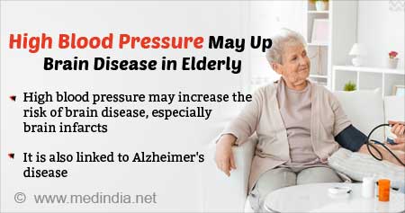 High Blood Pressure in Later Life May Link to Alzheimer's Disease