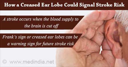 Creased Ear Lobe to Predict Stroke Risk