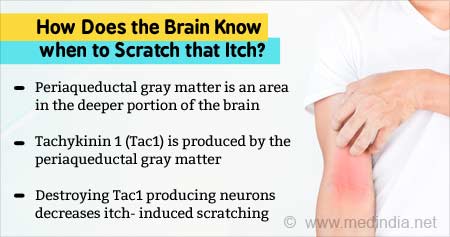 Scratch That Itch: Brain Mechanism Identified