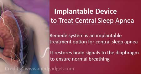 Implantable Device to Treat Central Sleep Apnea