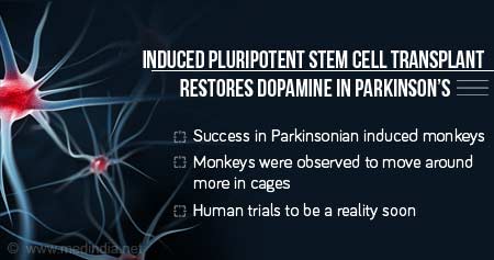 Possible Treatment for Parkinson's with Stem Cell Therapy