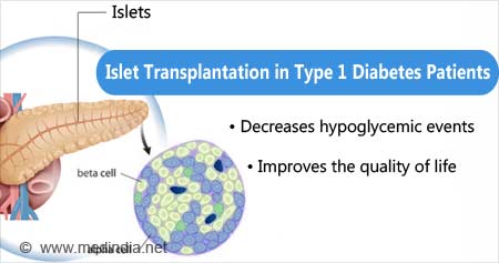 Islet Transplantation in Type 1 Diabetes Patients
