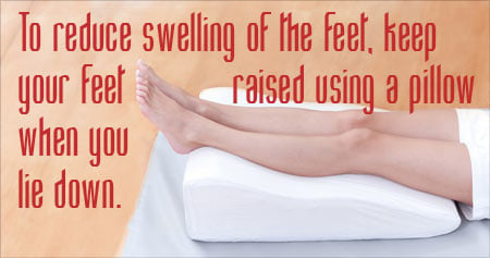 Useful Swollen Feet