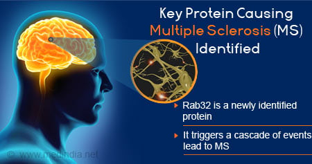 Key Protein Causing Multiple Sclerosis Identified