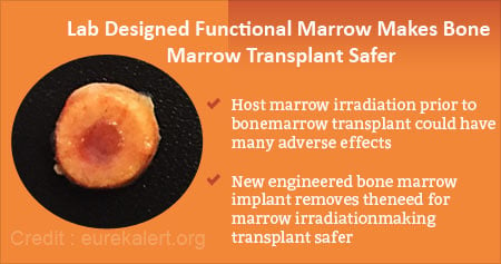 New Bone Marrow Implant for Safer Marrow Transplant