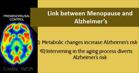 Alzheimer's Risk in Menopausal Women
