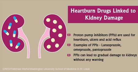 Effect Heartburn Drugs in Kidney Damage