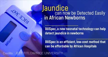 Low-cost Method to Detect Jaundice in African Newborns