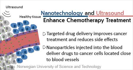 Focused Ultrasound and Microbubbles Improve Chemotherapy Drug Delivery