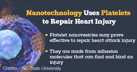 Nanotechnology to Repair Heart Injury