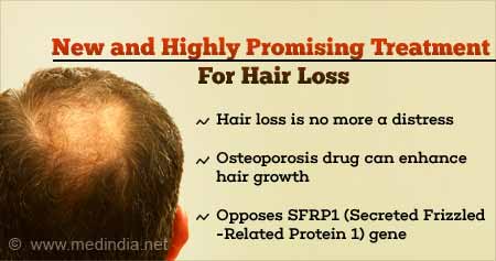 Health Tip on Promising Treatment for Hair Loss - Health Tips