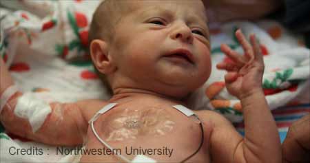 New Flexible Wireless Sensors Can Monitor Babies in the NICU