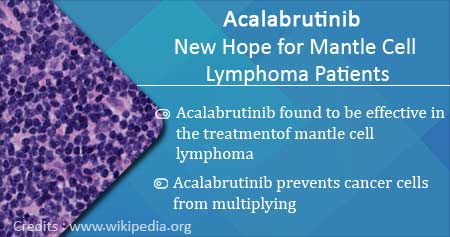 Breakthrough Therapy for Mantle Cell Lymphoma