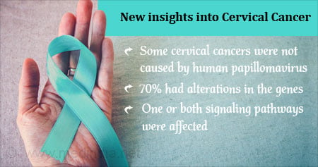 Health Tip  on New  Therapy for Cervical Cancer