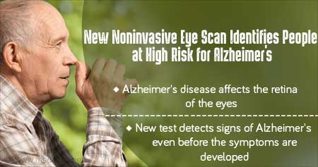 New & Early Detection Of Alzheimer's Disease