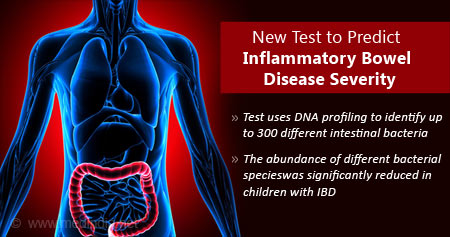 New Test to Predict Inflammatory Bowel Disease in Children