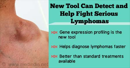 New Tool Can Help Fight Lymphoma - Here's How