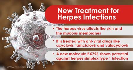 New Treatment for Herpes Infections
