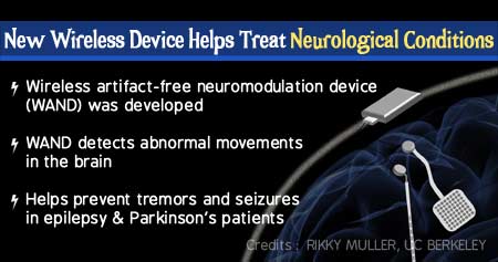 Wireless 'Pacemaker for the Brain' can Treat Epilepsy and Parkinson's