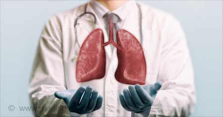New Approach can Help Regenerate Severely Damaged Lungs