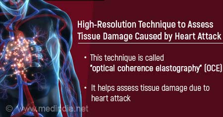 Novel Tool to Assess Tissue Damage Caused by Heart Attack